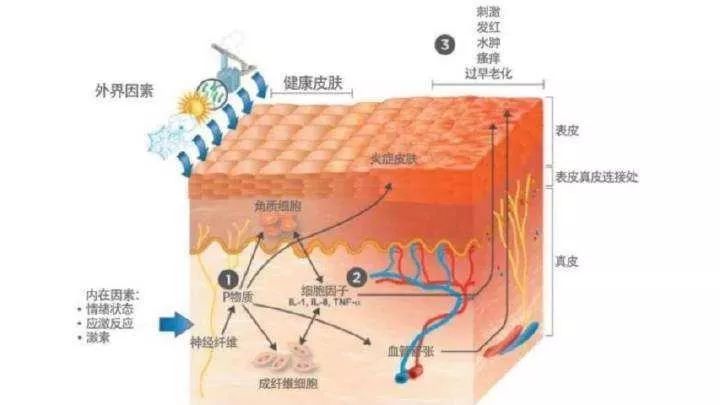 防城港市“屏障修復(fù)”修復(fù)的是什么？不同膚質(zhì)該如何搭配？